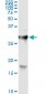 HYAL1 monoclonal antibody (M01), clone 2H7